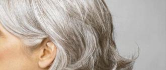 Sijeda kosa: razlozi njezine rane pojave